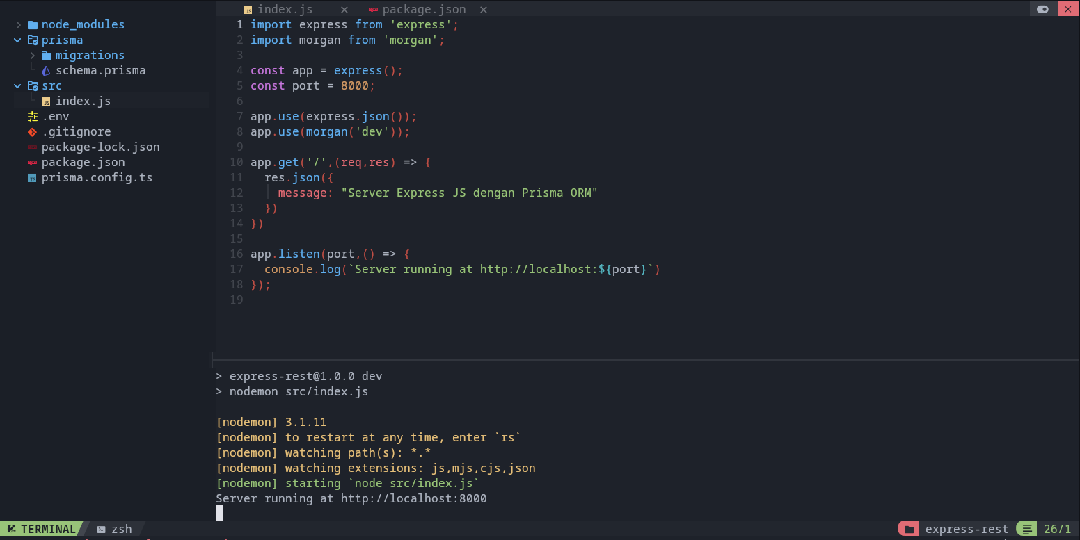 Berhasil setup express dengan prisma